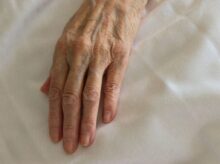 persons left hand on white textile