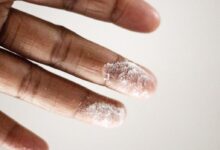 close-up photo of person's finger with white powder