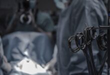 gray surgical scissors near doctors in operating room