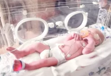 baby lying in incubator