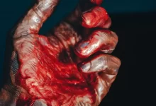 a person's hand with blood on it