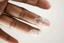 close-up photo of person's finger with white powder