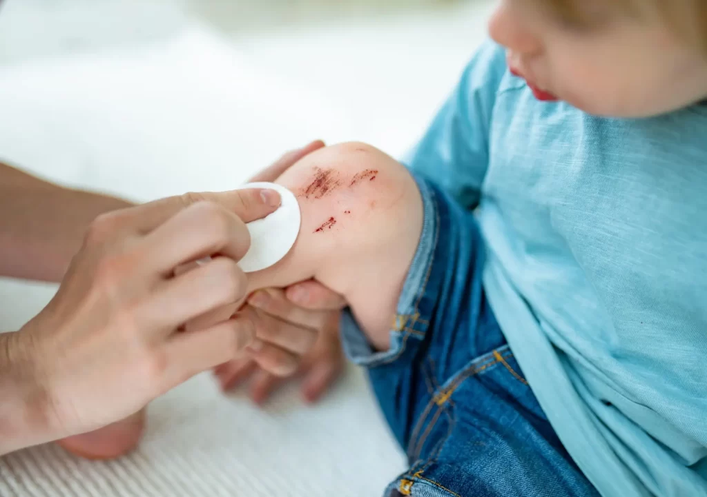 Shutterstock_2318962321 - Pravda24 Dítě s odřeným kolenem