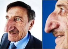 Muž s největším nosem na světě