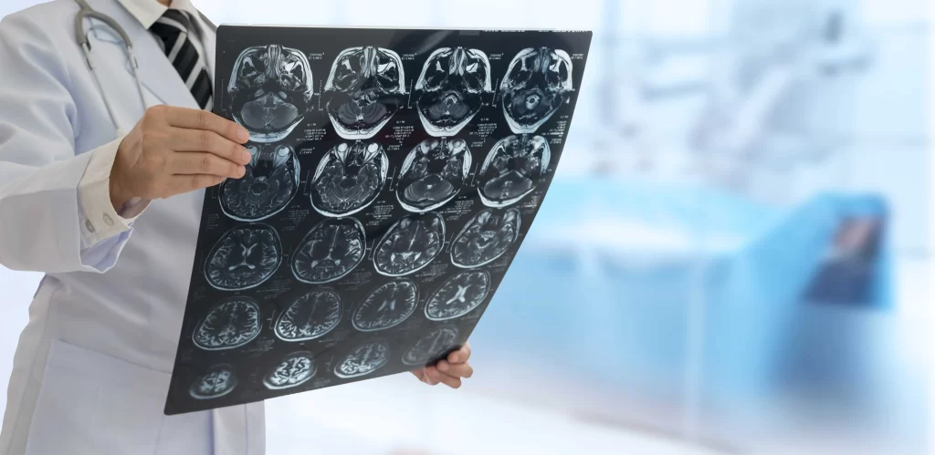 shutterstock_1810115158_optimized - Pravda24 lékař si prohlíží ct mozku